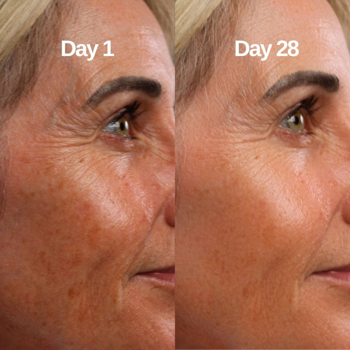 Can a Collagen Mask for Fine Lines Help?