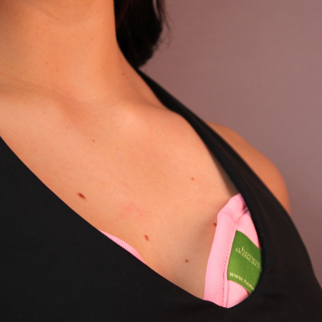 Castor Oil Breast Wraps